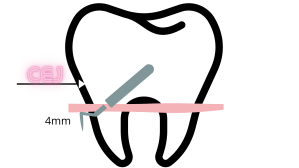 How to Calculate CAL – RDHopes.com